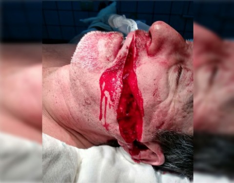 Acuchilló al cardiólogo por “serruchar” a su esposa