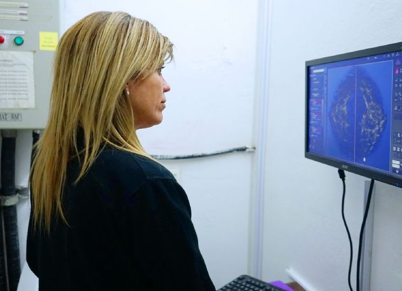 Desde las 8 horas de este miércoles se larga la maratón mamográfica en el Hospital Irurzun